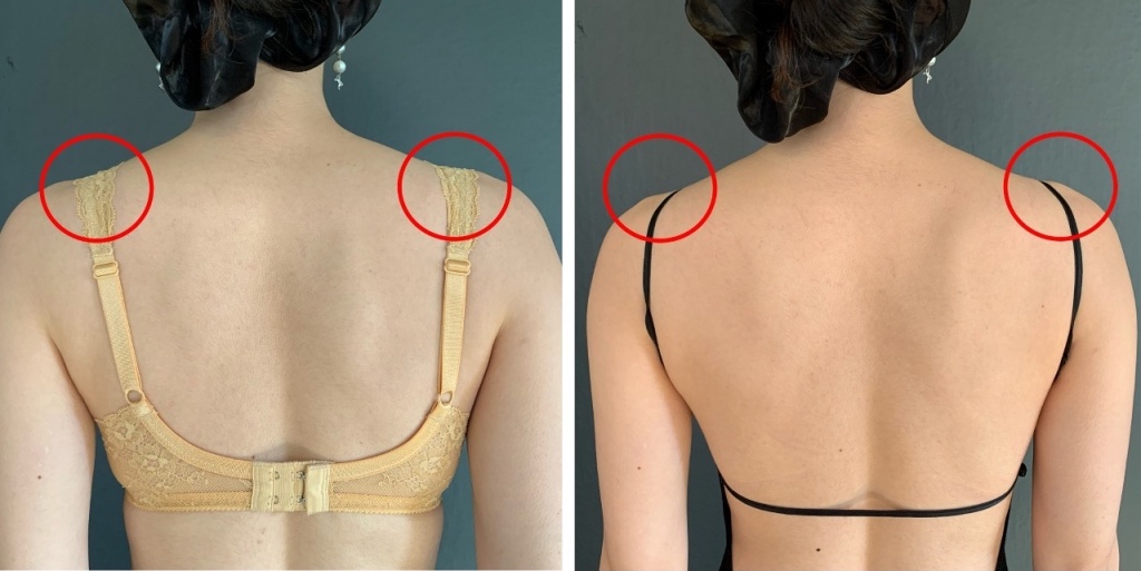 左：一般的なストラップ位置　右：Rosa Open Back Bodyのストラップ位置
